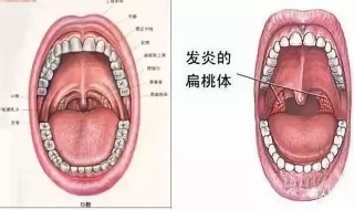 中新网:新澳门资料大全正版资料4不像-急性化脓性扁桃体炎吃什么药