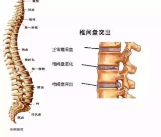 网易:澳门一肖一码100%精准-腰椎骶化是什么意思