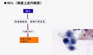 知乎：白小姐四肖四码100%准-宫颈活检是什么意思