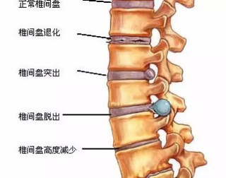 网易:澳门一肖一码100%精准-腰椎骶化是什么意思