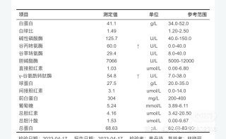 搜狗订阅:白小姐一肖一码期准今晚开奖-丙氨酸氨基转移酶高是什么意思