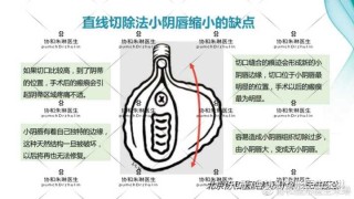 搜狐订阅：最准一肖一码一一子中特-阴唇长什么样