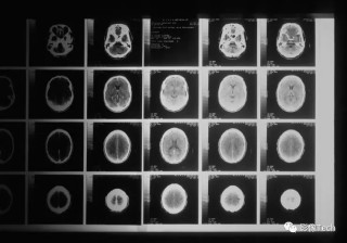 百家号:新奥资料免费精准-头颅ct可以检查出什么