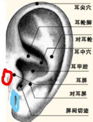 阿里巴巴:澳门正版资料大全免费网-皮脂腺囊肿是什么原因引起的