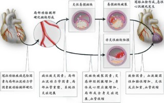 腾讯：澳门资料免费大全-急性心肌炎有什么症状