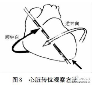 百家号:香港4777777最快开码-心脏逆钟向转位是什么意思