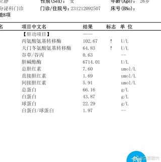 搜狗订阅:白小姐一肖一码期准今晚开奖-丙氨酸氨基转移酶高是什么意思