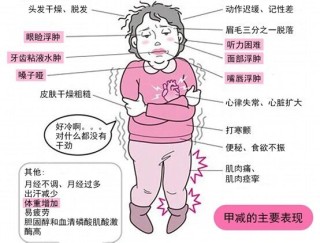 搜狐订阅：澳门正版大全免费资料-甲减是什么原因引起的