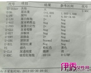 搜狗订阅:最准一肖一码一一子中特-尿沉渣是查什么的