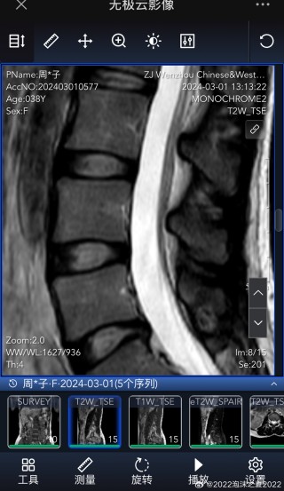 中新网:澳门六开奖结果2024开奖记录查询-硬膜囊受压是什么意思