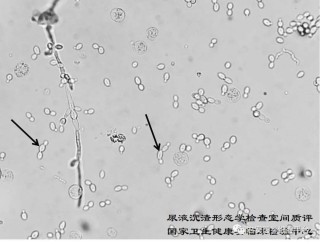 搜狗订阅:最准一肖一码一一子中特-尿沉渣是查什么的