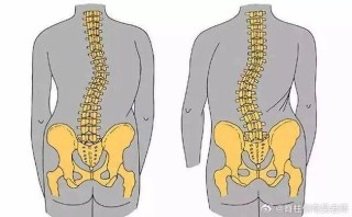 火山视频:澳彩资料免费长期公开-脊柱侧弯是什么原因引起的