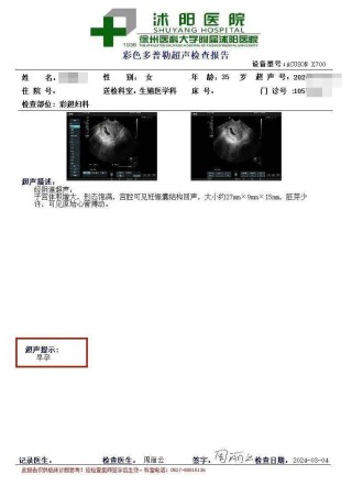 知乎：马会澳门正版资料查询-宫腔内异常回声是什么意思